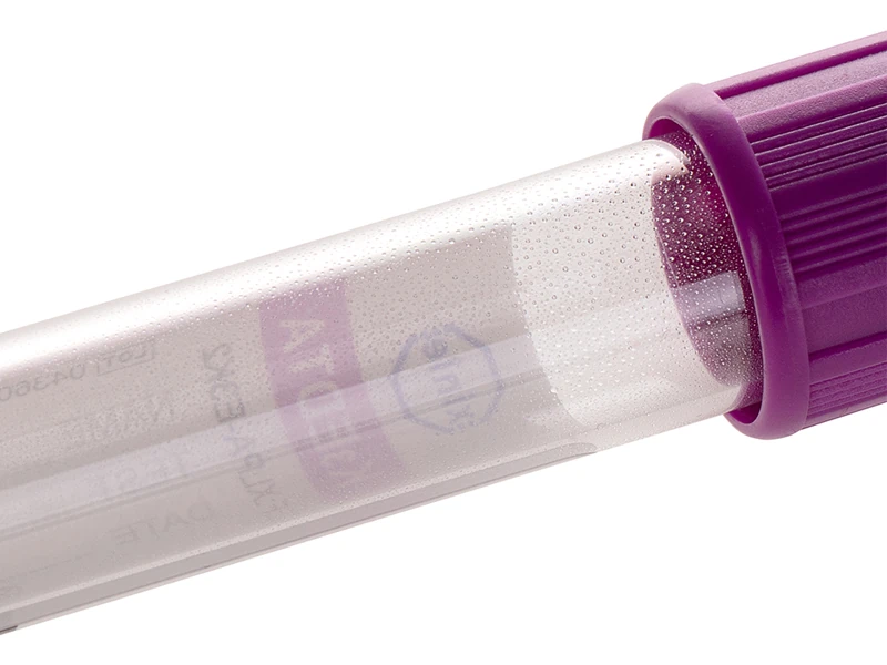 how do blood collection tube additives and inner wall treatment affect test results 01