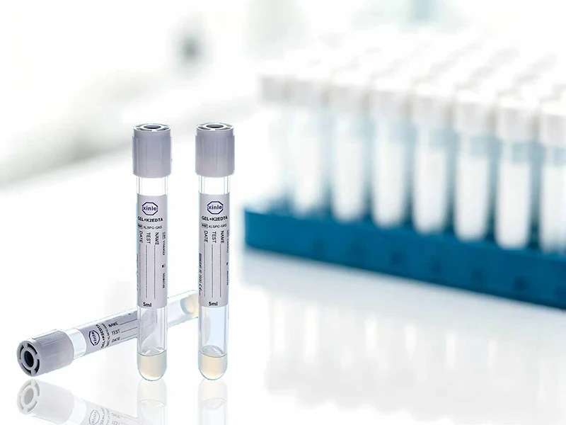 plasma preparation tubes for viral load testing performance and operational considerations